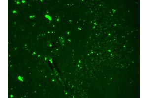 Image no. 4 for anti-Sodium Channel, Voltage-Gated, Type IX, alpha Subunit (SCN9A) (AA 1751-1946) antibody (FITC) (ABIN2483098)