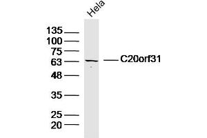 anti-ER Degradation Enhancer, Mannosidase alpha-Like 2 (EDEM2) (AA 101-200) antibody