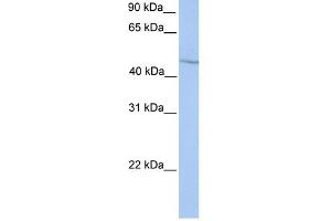 Image no. 1 for anti-Homeobox A13 (HOXA13) (Middle Region) antibody (ABIN2777518)