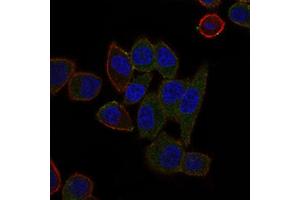 Image no. 5 for anti-ATP-Binding Cassette, Sub-Family B (MDR/TAP), Member 5 (ABCB5) (AA 481-674) antibody (ABIN1842667)