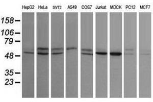 Image no. 7 for anti-serine/threonine Kinase 38 Like (STK38L) (AA 1-281) antibody (ABIN1490699)