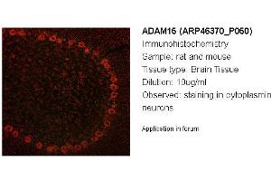 Image no. 2 for anti-ADAM Metallopeptidase Domain 15 (ADAM15) (Middle Region) antibody (ABIN2782601)