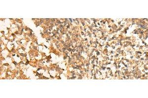 Immunohistochemistry of paraffin-embedded Human tonsil tissue using CEP57 Polyclonal Antibody at dilution of 1:30(x200)