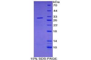 Image no. 1 for Pyruvate Dehydrogenase Phosphatase (PDP) protein (ABIN3011412)
