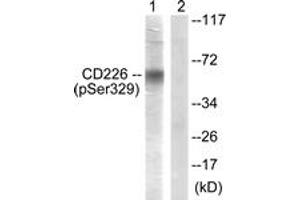 Western blot analysis of extracts from COS7 cells, using CD226/DNAM-1 (Phospho-Ser329) Antibody.