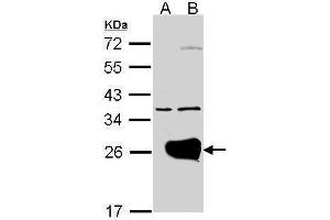 WB Image Western Blot analysis of RAB1A expression in transfected 293T cell line by RAB1A polyclonal antibody.