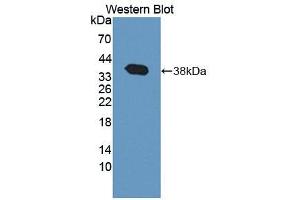 Image no. 2 for anti-Tensin 3 (TNS3) (AA 1-301) antibody (ABIN1871761)