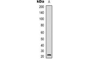 Image no. 2 for anti-A Kinase (PRKA) Interacting Protein 1 (AKIP1) antibody (ABIN2801117)