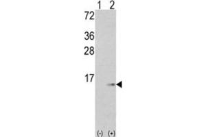 Image no. 3 for anti-S100 Calcium Binding Protein A6 (S100A6) antibody (ABIN3003159)