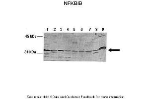 Image no. 3 for anti-NF-kappa-B inhibitor beta (NFKBIB) (N-Term) antibody (ABIN2775762)