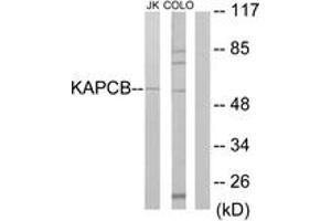 Image no. 1 for anti-Protein Kinase, CAMP Dependent, Catalytic, beta (PRKACB) (AA 291-340) antibody (ABIN1533661)