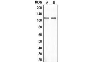 Western blot analysis of CLIP2 expression in SHSY5Y (A), A549 (B) whole cell lysates.