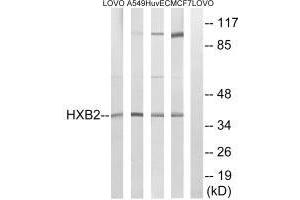 HOXB2 antibody