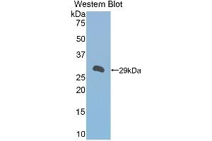Image no. 1 for anti-alpha-1-B Glycoprotein (A1BG) (AA 220-415) antibody (ABIN1857838)