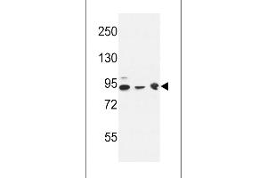 Western Blotting (WB) image for anti-DnaJ (Hsp40) Homolog, Subfamily C, Member 6 (DNAJC6) antibody (ABIN2158578)