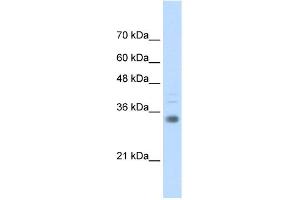Image no. 1 for anti-Homeobox B4 (HOXB4) (C-Term) antibody (ABIN2781202)