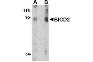 Image no. 1 for anti-Bicaudal D Homolog 2 (BICD2) (C-Term) antibody (ABIN499457)