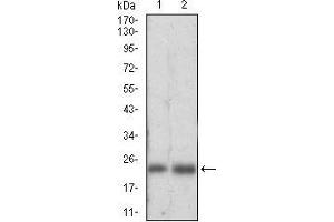 Image no. 7 for anti-Ferritin, Light Polypeptide (FTL) (AA 1-157), (full length) antibody (ABIN2682991)