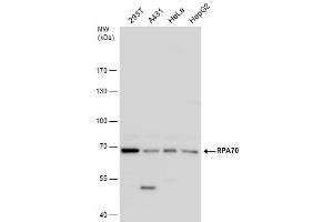 Image no. 7 for anti-Replication Protein A1, 70kDa (RPA1) (C-Term) antibody (ABIN2856633)