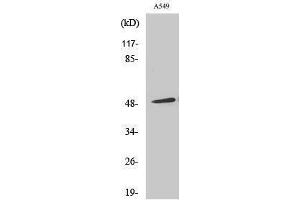 Western Blotting (WB) image for anti-Arrestin, beta 1 (ARRB1) (Ser157) antibody (ABIN3183382)