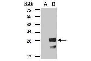 Image no. 1 for anti-Regulator of G-Protein Signalling 19 (RGS19) (C-Term) antibody (ABIN2856312)