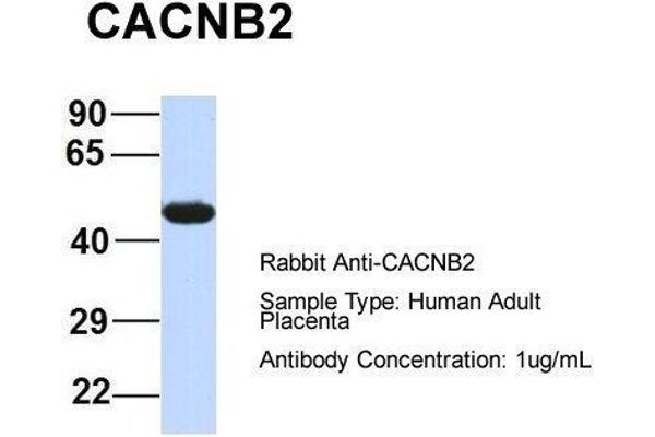 anti-Calcium Channel, Voltage-Dependent, beta 4 Subunit (CACNB4) (Middle Region) antibody