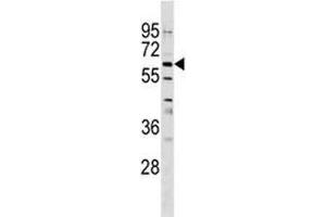 Image no. 1 for anti-Osteoactivin (GPNMB) (AA 541-569) antibody (ABIN3032103)