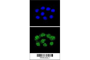 Image no. 2 for anti-Mismatch Repair Protein 2 (MSH2) (AA 637-665) antibody (ABIN655517)