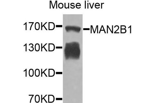 anti-Mannosidase, Alpha, Class 2B, Member 1 (MAN2B1) antibody
