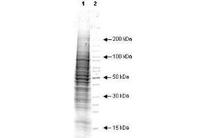 Image no. 1 for A431 Whole Cell Lysate (EGF Stimulated) (ABIN964022)