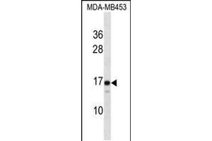 Image no. 1 for anti-Lens Intrinsic Membrane Protein 2, 19kDa (LIM2) (AA 110-137), (C-Term) antibody (ABIN5536537)