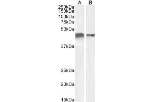 Image no. 8 for anti-Actin, alpha 2, Smooth Muscle, Aorta (ACTA2) (N-Term) antibody (ABIN185271)