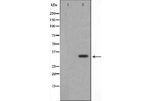 Image no. 1 for anti-Protein Phosphatase 1, Regulatory (Inhibitor) Subunit 1B (PPP1R1B) antibody (ABIN6261225)