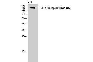 Image no. 1 for anti-Transforming Growth Factor, beta Receptor III (TGFBR3) (Tyr160) antibody (ABIN3180916)