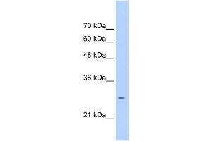 Image no. 1 for anti-Aspartate beta-Hydroxylase (ASPH) (N-Term) antibody (ABIN2784532)