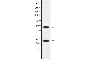 anti-APOBEC3A and APOBEC3B Deletion Hybrid (APOBEC3A_B) antibody