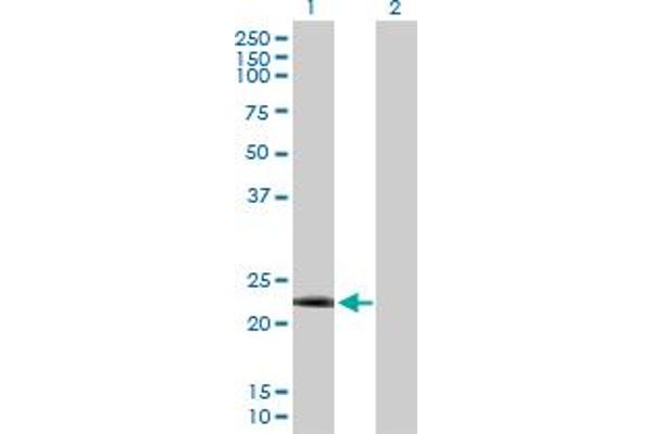 DYDC2 Antikörper  (AA 1-177)