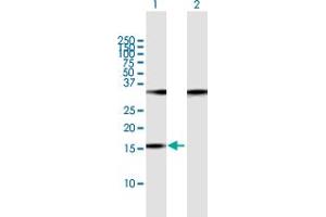 Image no. 1 for anti-Processing of Precursor 7, Ribonuclease P/MRP Subunit (POP7) (AA 1-140) antibody (ABIN523657)