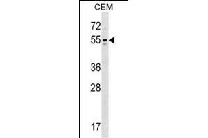 KCNA6 Antibody (N-term) (ABIN1538816 and ABIN2848827) western blot analysis in CEM cell line lysates (35 μg/lane).