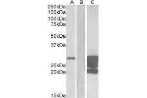 Image no. 1 for anti-GM2 Ganglioside Activator (GM2A) (AA 179-189) antibody (ABIN625813)