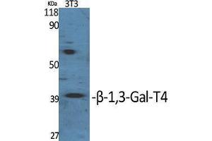 Image no. 1 for anti-UDP-Gal:betaGlcNAc beta 1,3-Galactosyltransferase, Polypeptide 4 (B3GALT4) (Internal Region) antibody (ABIN3180957)