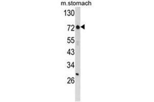 Image no. 1 for anti-Zinc Finger Protein 823 (ZNF823) (Middle Region) antibody (ABIN453879)