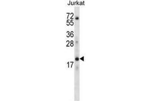 KRTAP13-3 Antibody (C-term) western blot analysis in Jurkat cell line lysates (35µg/lane).