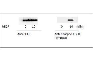 Image no. 2 for Epidermal Growth Factor Receptor (EGFR) ELISA Kit (ABIN1981827)