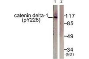 Western blot analysis of extracts from HuvEc cells, using Catenin-delta1 (Phospho-Tyr228) Antibody.
