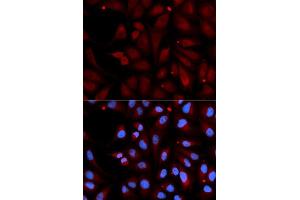 Image no. 1 for anti-Monoamine Oxidase B (MAOB) antibody (ABIN3022152)