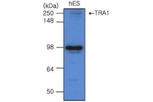 Image no. 5 for anti-Heat Shock Protein 90kDa beta (Grp94), Member 1 (HSP90B1) (AA 676-803) antibody (ABIN317570)