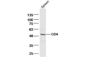 Mouse spleen lysates probed with CD4 Polyclonal Antibody, Unconjugated  at 1:500 dilution and 4˚C overnight incubation.
