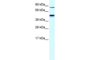 Image no. 1 for anti-erythrocyte Membrane Protein Band 4.2 (EPB42) antibody (ABIN2460809)