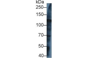 Image no. 2 for anti-Kinesin Family Member 5A (KIF5A) (AA 823-1027) antibody (ABIN1859531)